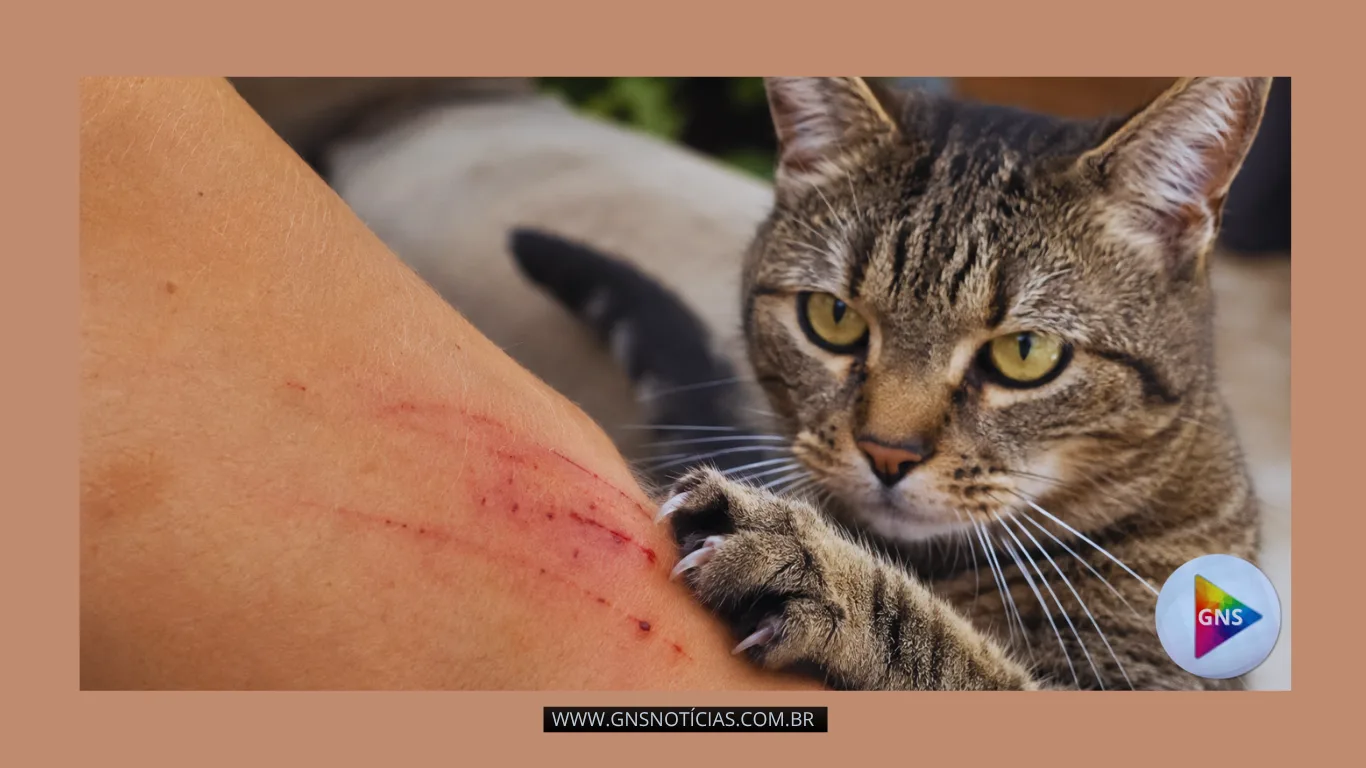 Corpo-30 ALERTA DE SAÚDE: arranhões de gatos e cachorros podem causar infecções graves; especialistas reforçam cuidados com animais domésticos